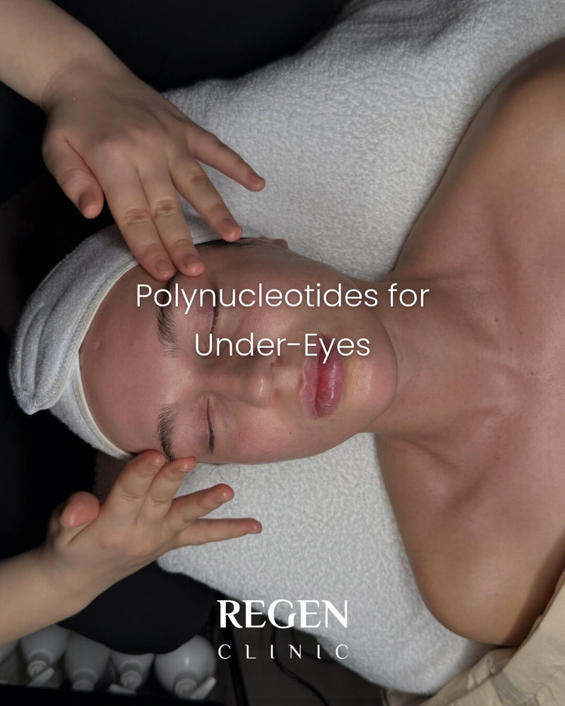 Under-eye skin assessment at REGEN Clinic — polynucleotide treatment area