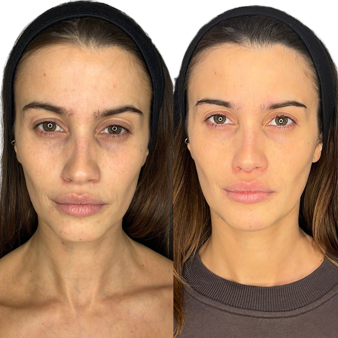 Polynucleotides Treatment