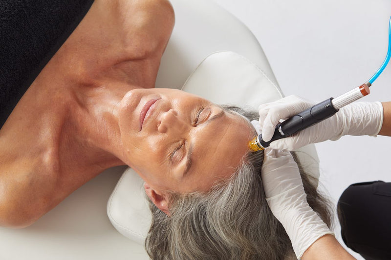 Keravive scalp recovery — a six-week scalp-and-hair timeline
