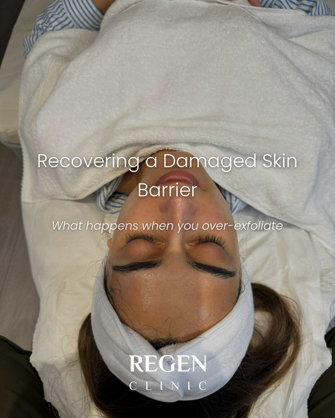 Barrier-repair focused skin treatment at REGEN Clinic